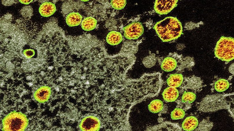 Virus Corona dalam Gambar: Bagaimana Virus Ini COVID 19 Mengubah Dunia